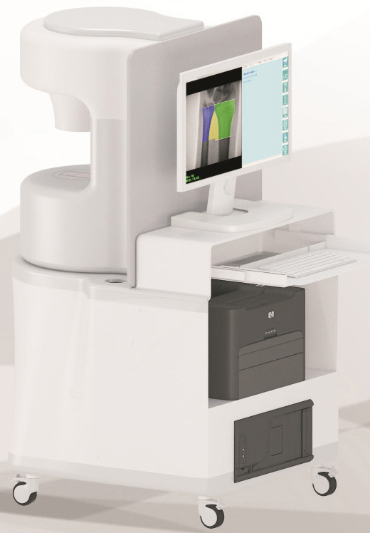 数字双能X线骨密度仪